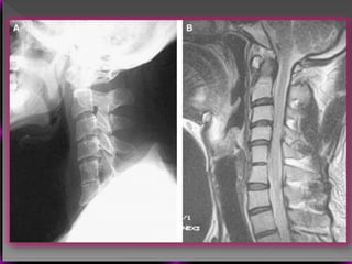 Vertebral Pathologies Comprehensive Overview of Vertebral Anatomy, Pathologies, and Imaging ...