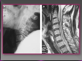 Vertebral Pathologies Comprehensive Overview of Vertebral Anatomy, Pathologies, and Imaging ...