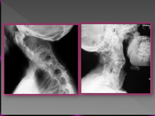 Vertebral Pathologies Comprehensive Overview of Vertebral Anatomy, Pathologies, and Imaging ...