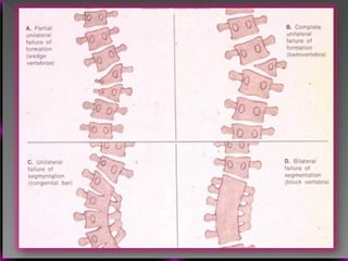Vertebral Pathologies Comprehensive Overview of Vertebral Anatomy, Pathologies, and Imaging ...