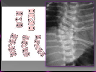 Vertebral Pathologies Comprehensive Overview of Vertebral Anatomy, Pathologies, and Imaging ...