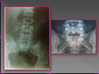 Vertebral Pathologies Comprehensive Overview of Vertebral Anatomy, Pathologies, and Imaging ...
