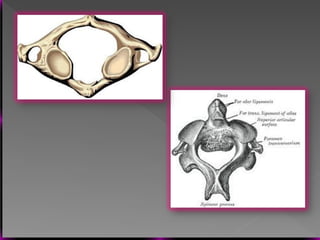 Vertebral Pathologies Comprehensive Overview of Vertebral Anatomy, Pathologies, and Imaging ...