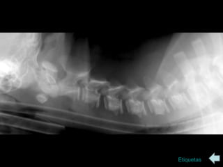 radiologia Columna vertebral | PPS