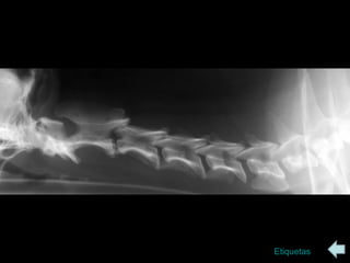 radiologia Columna vertebral | PPS