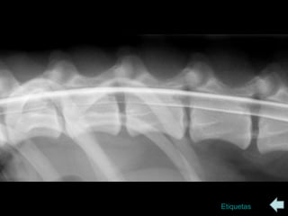 radiologia Columna vertebral | PPS