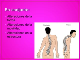 • Alteraciones de la
forma
• Alteraciones de la
movilidad
• Alteraciones en la
estructura
 