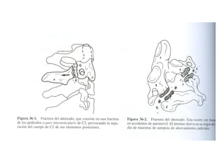 Columna vertebral generalidades
