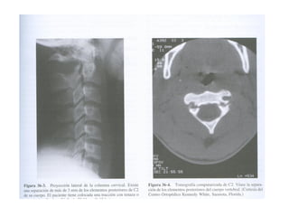 Columna vertebral generalidades