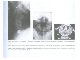 Columna vertebral generalidades