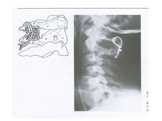 Columna vertebral generalidades