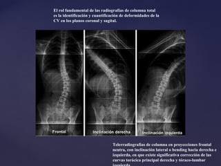 Columna vertebral , Basico | PPT
