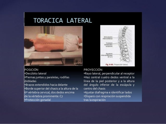 Sheynyy la osteocondrosis del ejercicio del doctor bubnovskogo