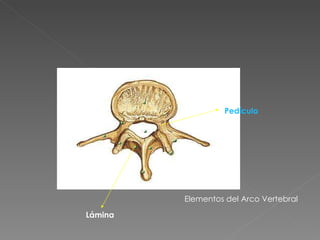 Pedículo Lámina Elementos del Arco Vertebral 