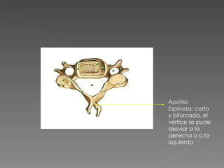 Apófisis Espinosa: corta y bifurcada, el vértice se pude desviar a la derecha o a la izquierda 