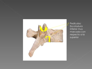 Pedículos: Escotadura inferior muy marcada con respecto a la superior 