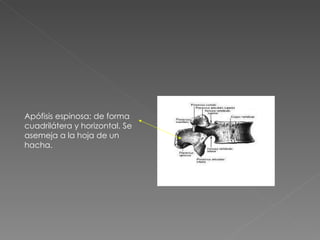 Apófisis espinosa: de forma cuadrilátera y horizontal. Se asemeja a la hoja de un hacha. 