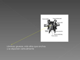 Láminas: gruesas, más altas que anchas y se disponen verticalmente 