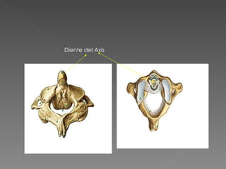 Diente del Axis 