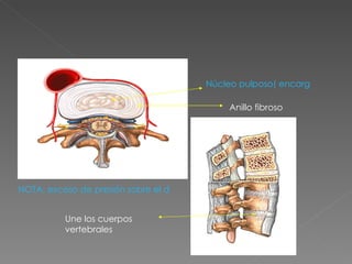 Anillo fibroso Núcleo pulposo( encargado de resistir las fuerzas en sentido axial) Une los cuerpos vertebrales NOTA: exceso de presión sobre el disco produce: hernia del Disco 