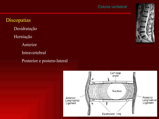 Coluna vertebral Discopatias Desidratação Herniação Anterior Intravertebral Posterior e postero-lateral 