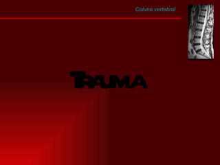 Coluna vertebral Trauma 