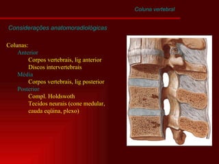Coluna vertebral Considerações anatomoradiológicas Colunas: Anterior Corpos vertebrais, lig anterior Discos intervertebrais Média Corpos vertebrais, lig posterior Posterior   Compl. Holdswoth Tecidos neurais (cone medular,  cauda eqüina, plexo) 