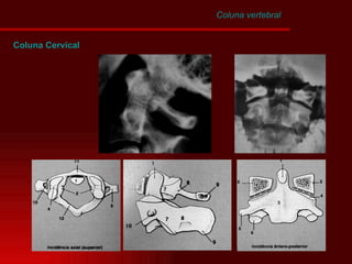 Coluna vertebral Coluna Cervical 