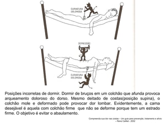 Posições incorretas de dormir. Dormir de bruços em um colchão que afunda provoca arqueamento doloroso do dorso. Mesmo deitado de costas(posição supina), o colchão mole e deformado pode provocar dor lombar. Evidentemente, a cama desejável é aquela com colchão firme  que não se deforme porque tem um estrado firme. O objetivo é evitar o abaulamento.  Compreenda sua dor nas costas – Um guia para prevenção, tratamento e alívio – Rene Cailliet - 2002 
