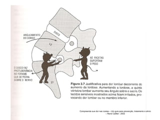 Compreenda sua dor nas costas – Um guia para prevenção, tratamento e alívio – Rene Cailliet - 2002 