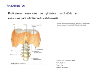 TRATAMENTO: Praticam-se exercícios de ginástica respiratória e exercícios para o trofismo dos abdominais.  Tratado de Exercícios Corretivos – Aplicados a Reeducação Motora Postural- FRANCESCO TRIBASTONE - 2002 Anatomia para Estudantes – 2005 Richard L. Drake Wayne Volg Adam W. M. Mitchell 