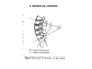 A  MEDIDA DA LORDOSE 