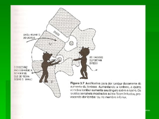Compreenda sua dor nas costas – Um guia para prevenção, tratamento e alívio – Rene Cailliet - 2002 