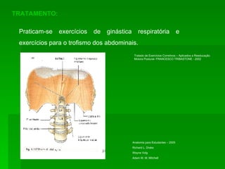 TRATAMENTO: Praticam-se exercícios de ginástica respiratória e exercícios para o trofismo dos abdominais.  Tratado de Exercícios Corretivos – Aplicados a Reeducação Motora Postural- FRANCESCO TRIBASTONE - 2002 Anatomia para Estudantes – 2005 Richard L. Drake Wayne Volg Adam W. M. Mitchell 