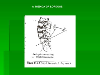 A  MEDIDA DA LORDOSE 