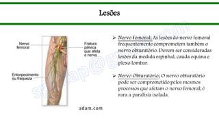 Lesões
 Nervo Femoral; As lesões do nervo femoral
frequentemente comprometem também o
nervo obturatório. Devem ser consideradas
lesões da medula espinhal, cauda equina e
plexo lombar.
 Nervo Obturatório; O nervo obturatório
pode ser comprometido pelos mesmos
processos que afetam o nervo femoral; é
rara a paralisia isolada.
 