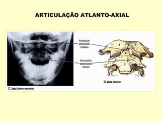 ARTICULAÇÃO ATLANTO-AXIAL
 