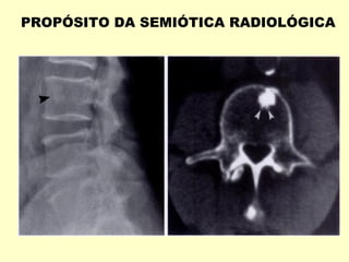 PROPÓSITO DA SEMIÓTICA RADIOLÓGICA
 