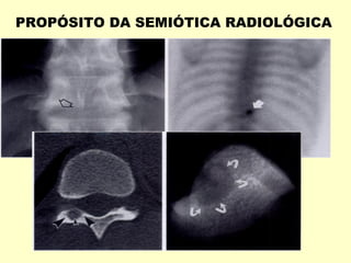 PROPÓSITO DA SEMIÓTICA RADIOLÓGICA
 