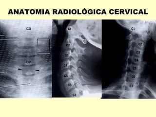 ANATOMIA RADIOLÓGICA CERVICAL
 