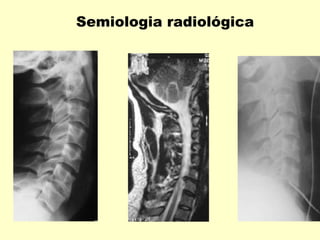 Semiologia radiológica
 
