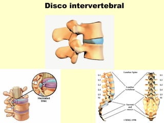 Disco intervertebral
 