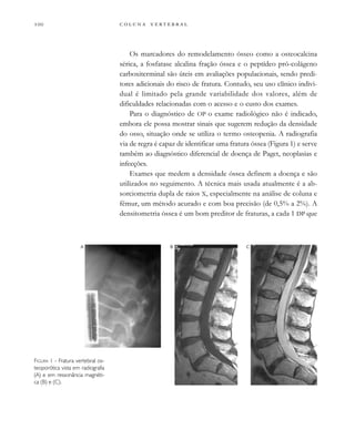         
Os marcadores do remodelamento ósseo como a osteocalcina
sérica, a fosfatase alcalina fração óssea e o peptídeo pró-colágeno
carboxiterminal são úteis em avaliações populacionais, sendo predi-
tores adicionais do risco de fratura. Contudo, seu uso clínico indivi-
dual é limitado pela grande variabilidade dos valores, além de
dificuldades relacionadas com o acesso e o custo dos exames.
Para o diagnóstico de OP o exame radiológico não é indicado,
embora ele possa mostrar sinais que sugerem redução da densidade
do osso, situação onde se utiliza o termo osteopenia. A radiografia
via de regra é capaz de identificar uma fratura óssea (Figura 1) e serve
também ao diagnóstico diferencial de doença de Paget, neoplasias e
infecções.
Exames que medem a densidade óssea definem a doença e são
utilizados no seguimento. A técnica mais usada atualmente é a ab-
sorciometria dupla de raios X, especialmente na análise de coluna e
fêmur, um método acurado e com boa precisão (de 0,5% a 2%). A
densitometria óssea é um bom preditor de fraturas, a cada 1 DP que
FIGURA 1 - Fratura vertebral os-
teoporótica vista em radiografia
(A) e em ressonância magnéti-
ca (B) e (C).
CBA
 