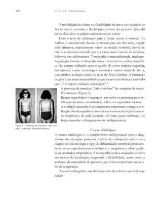         
A mobilidade da coluna e a flexibilidade da curva são avaliadas na
flexão lateral, extensão e flexão para a frente do paciente. Quando
existir dor, deve-se palpar cuidadosamente a área.
Com o teste de inclinação para a frente ocorre a correção da
lordose, e acontecendo desvio do tronco para um dos lados, sugere
lesão irritativa, especialmente tumor de medula vertebral, hérnia de
disco ou osteoma osteóide que é a causa mais comum de escoliose
dolorosa em adolescentes. Tomografia computadorizada, mielogra-
fia, punção lombar, cintilografia óssea e ressonância nuclear magnéti-
ca são exames indicados para o quadro de curva torácica esquerda,
dor intensa, exame neurológico anormal e outros sinais de alerta,
para melhor avaliação ainda no teste de flexão lombar. A formação
de giba é um sinal característico de que a curva escoliótica é maior do
que 10o
e requer avaliação radiológica(5-6)
.
A presença de manchas “café com leite” faz suspeitar de neuro-
fibromatose (Figura 5).
Exame neurológico é necessário em todos os pacientes para ve-
rificação do tônus, sensibilidade, reflexos e capacidade motora.
A avaliação muscular é extremamente importante porque a veri-
ficação dos desequilíbrios musculares é essencial no planejamen-
to terapêutico de cada paciente. Os testes para verificação da
força muscular e alongamento são indispensáveis.
Exame Radiológico
O exame radiológico é o complemento indispensável para o diag-
nóstico das alterações posturais. Através das radiografias obtém-se o
diagnóstico da etiologia e tipo de deformidade vertebral, proceden-
do-se ao acompanhamento evolutivo e o prognóstico, observando-
se os resultados terapêuticos. A radiografia inclui a avaliação da curva
em termos de localização, magnitude e flexibilidade, assim como a
avaliação da maturidade do paciente, que é fator importante na esco-
lha da terapêutica.
A rotina radiográfica nas deformidades da coluna vertebral deve
incluir:
Figura 5 – Presença de manchas “café com
leite”, indicando neurofibromatose.
 