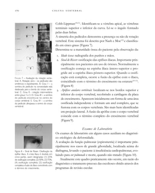         
Cobb-Lippman(10,11)
. Identificam-se a vértebra apical, as vértebras
terminais superior e inferior da curva. Lê-se o ângulo formado
pelas duas linhas.
A simetria dos pedículos demonstra a presença ou não de rotação
vertebral. Este sistema foi descrito por Nash e Moe(12)
e classifica-
do em cinco graus (Figura 7).
Determina-se a maturidade óssea do paciente pela observação da:
. Idade óssea: radiografia dos punhos e mãos.
. Sinal de Risser: ossificação das epífises ilíacas. Importante prin-
cipalmente nos pacientes em uso de órteses. Normalmente a
ossificação começa na espinha ilíaca ântero-superior e pro-
gride até a espinha ilíaca póstero-superior. Quando a ossifi-
cação está completa, ocorre a fusão da epífise com o ilíaco,
coincidindo com o término do crescimento na estatura(10-13)
.
(Figura 8)
. Apófises anulares vertebrais: localizam-se nos bordos superior e
inferior do corpo vertebral, recobrindo a cartilagem da placa
de crescimento. Aparecem inicialmente em forma de uma área
ossificada independente e formam um anel completo, que se
fusiona com os corpos vertebrais. São mais bem identificadas
em projeção lateral. A fusão da apófise com o corpo vertebral
coincide com o término completo do crescimento vertebral
(Figura 9).
Exames de Laboratório
Os exames de laboratório em alguns casos auxiliam no diagnósti-
co etiológico da deformidade.
A avaliação da função pulmonar (espirometria) é importante prin-
cipalmente nos casos de grande gibosidade, localizada acima do
diafragma, levando o paciente à insuficiência cardiopulmonar, evo-
luindo para cor pulmonale e morte, quando não tratado (Figura 10).
Atualmente este quadro praticamente não ocorre, em razão do
diagnóstico e tratamento precoce das escolioses obtido através dos
programas de revisão escolar.
FIGURA 7 – Avaliação da rotação verte-
bral. A. Rotação zero - os pedículos são
simétricos e eqüidistantes. B. Grau 1 – a
sombra do pedículo na convexidade está
deslocada para a borda do corpo verte-
bral. C. Grau II - rotação intermediária
entre graus 1 e 3. D. Grau III – a sombra
do pedículo encontra-se no centro do
corpo vertebral. E. Grau IV – a sombra
do pedículo ultrapassa o centro do corpo
vertebral.
Figura 8 – Sinal de Risser. Ossificação da
epífise ilíaca. A crista ilíaca é dividida em
cinco partes, assim designadas: (1) 25%
de ossificação completa; (2) 50%; (3) 75%;
(4) ossificação completa; (5) ossificação
completa e fusão do ilíaco coincidindo com
o término do crescimento.
 