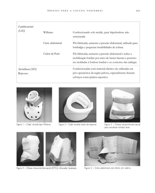                 
Williams
Cinta abdominal
Colete de Putti
Confeccionado sob molde, para hiperlordose não
estruturada
Pré-fabricada, aumento a pressão abdominal, utilizado para
lombalgia e pequenas instabilidades de coluna
Pré-fabricada, aumento a pressão abdominal e reduz a
mobilização lombar por meio de hastes laterais e posterio-
res moldadas à lordose lombar e ao contorno das nádegas
Confeccionadas com material elástico são utilizadas em
pós-operatórios da região pélvica, especialmente durante
esforços como prática esportiva
Lombossacrais
(LSO)
Sacroilíacas (SIO)
Repouso
Figura 4 – Órtese tóraco-lombo-sacral (OTLS) infra-axilar bivalvada.
Figura 1 – Colar cervical tipo Minerva. Figura 2 – Colar cervical macio de espuma.
Figura 5 – Cinta abdominal com fecho em velcro.
Figura 3 – Órtese tóraco-lombo-sacral
para escoliose lombar leve.
 