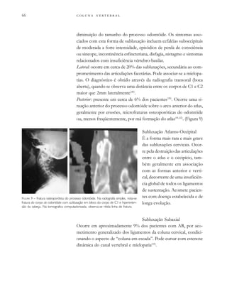         
diminuição do tamanho do processo odontóide. Os sintomas asso-
ciados com esta forma de subluxação incluem cefaléias suboccipitais
de moderada a forte intensidade, episódios de perda de consciência
ou síncope, incontinência esfincteriana, disfagia, nistagmo e sintomas
relacionados com insuficiência vértebro-basilar.
Lateral: ocorre em cerca de 20% das subluxações, secundária ao com-
prometimento das articulações facetárias. Pode associar-se a mielopa-
tias. O diagnóstico é obtido através da radiografia transoral (boca
aberta), quando se observa uma distância entre os corpos de C1 e C2
maior que 2mm lateralmente(40)
.
Posterior: presente em cerca de 6% dos pacientes(39)
. Ocorre uma si-
tuação anterior do processo odontóide sobre o arco anterior do atlas,
geralmente por erosões, microfraturas osteoporóticas do odontóide
ou, menos freqüentemente, por má formação do atlas(41,42)
. (Figura 9)
Subluxação Atlanto-Occipital
É a forma mais rara e mais grave
das subluxações cervicais. Ocor-
re pela destruição das articulações
entre o atlas e o occipício, tam-
bém geralmente em associação
com as formas anterior e verti-
cal, decorrente de uma insuficiên-
cia global de todos os ligamentos
de sustentação. Acomete pacien-
tes com doença estabelecida e de
longa evolução.
Subluxação Subaxial
Ocorre em aproximadamente 9% dos pacientes com AR, por aco-
metimento generalizado dos ligamentos da coluna cervical, condici-
onando o aspecto de “coluna em escada”. Pode cursar com estenose
dinâmica do canal vertebral e mielopatia(43)
.
FIGURA 9 – Fratura osteoporótica do processo odontóide. Na radiografia simples, nota-se
fratura do corpo do odontóide com subluxação em bloco do corpo de C1 e hiperexten-
são da cabeça. Na tomografica computadorizada, observa-se nítida linha de fratura.
 