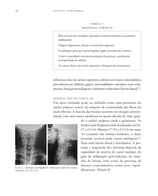         

infecciosos das vias aéreas superiores, adenites cervicais e osteomielites;
pós-infecciosos (difteria, gripe), anormalidades vasculares com com-
pressão, doenças neurológicas e síndromes radiculares (hérnia discal)(14)
.
HÉRNIAS DISCAIS CERVICAIS
Um disco herniado pode ser definido como uma protrusão do
núcleo pulposo através de soluções de continuidade das fibras do
ânulo fibroso. A maioria das hérnias ocorrem em situação póstero-
lateral, com uma maior incidência na quarta década de vida, quan-
do o núcleo pulposo ainda é gelatinoso. As
hérnias mais freqüentes estão localizadas em C6-
C7 e C5-C6. Hérnias C7-T1 e C3-C4 são raras.
Ao contrário das hérnias lombares, o disco
herniado cervical pode causar mielopatia(18)
.
Nem toda hérnia discal é sintomática. A pre-
sença e magnitude dos sintomas depende da
capacidade de reserva do canal medular, do
grau de inflamação peri-radicular, do tama-
nho da hérnia, bem como da presença de
doenças concomitantes, como p.ex. espon-
diloartrose. (Tabela 8)
TABELA 7
DISTENSÃO CERVICAL
Dor cervical não-irradiada, associada a estresse mecânico ou posturas
inadequadas
Origem: ligamentos, fáscias ou músculos regionais
Localização: pescoço, interescapular, região proximal dos ombros
A dor é exacerbada com movimentação do pescoço, geralmente
acompanhada de cefaléia
Ao exame físico: dor local, espasmos e bloqueio de movimentos
FIGURA 5 – Síndrome de Klippel-Feil. Observa-se fusão dos corpos
vertebrais C2, C3 e C4.
 