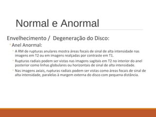 Normal e Anormal
Envelhecimento / Degeneração do Disco:
◦Anel Anormal:
◦ A RM de rupturas anulares mostra áreas focais de sinal de alta intensidade nas
imagens em T2 ou em imagens realçadas por contraste em T1.
◦ Rupturas radiais podem ser vistas nas imagens sagitais em T2 no interior do anel
posterior como linhas globulares ou horizontais de sinal de alta intensidade.
◦ Nas imagens axiais, rupturas radiais podem ser vistas como áreas focais de sinal de
alta intensidade, paralelas à margem externa do disco com pequena distância.
 