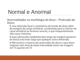 Normal e Anormal
Anormalidades na morfologia do disco – Protrusão do
Disco:
◦É uma extensão focal e assimétrica de tecido do disco além
da margem do corpo vertebral, usualmente para o interior do
canal vertebral ou forames neurais, o que frequentemente
não causa sintomas.
◦A base (dimensão mediolateralao longo da margem posterior
do disco) está mais larga que qualquer outra dimensão.
◦A RM mostra a maioria das protrusões do disco e seus disco
originais com sinal de baixa intensidade tanto nas imagens
em T1 quanto em T2
 